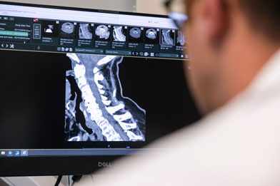 A male doctor reviews an MRI scan of a spine on a computer monitor.