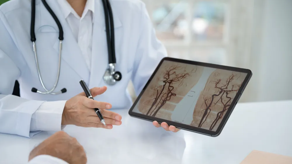 A neurosurgeon explains arteriovenous malformations in the brain